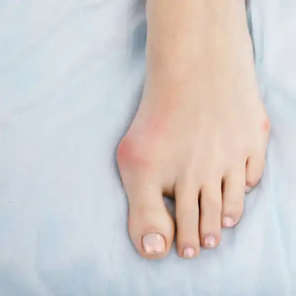 Can Wide Fitting Shoes Protect Your Feet BeastBeauty can-wide-fitting-shoes-protect-your-feet-beastbeauty